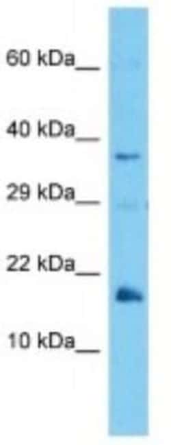 MUP-12 Rabbit anti-Mouse, Polyclonal, Novus Biologicals 100 &mu;g | Buy Online | Novus Biologicals | Fisher Scientific
